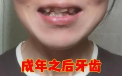 牙齿矫正后为何又歪了？反弹原因与解决方法详解？