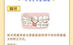 牙齿矫正怎么收牙缝？有哪些实用方法？