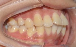 北京康圆口腔正畸