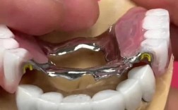 假牙佩戴的正确方法是什么？具体步骤有哪些？