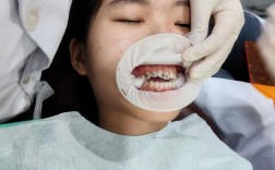 武汉卫校学生矫正牙齿，医院怎么选？费用和流程如何？