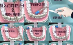 口腔引流常用方法有哪些？如何正确操作？