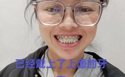 牙齿矫正 口腔溃疡