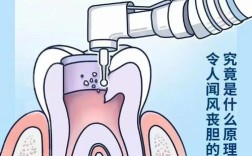 青少年牙髓炎治疗有哪些方法？如何选择兼顾发育与疗效？