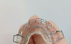 正畸推簧的正当使用究竟指什么？如何规范操作？