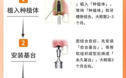 种植牙机的具体使用方法步骤是怎样的？