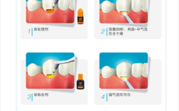 树脂充填器的正确使用方法具体包括哪些步骤？操作时需注意哪些细节以避免常见问题？