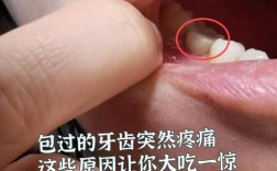 种牙后为何其它牙齿不舒服？是正常反应还是邻牙受影响？需要处理吗？