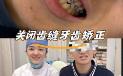 上海青少年矫正牙齿，最佳矫正年龄是几岁？