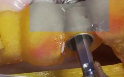 种植牙牙根松动是什么原因导致的？