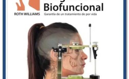 正畸美国RW是什么技术