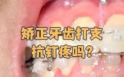 正畸支抗钉植入视频