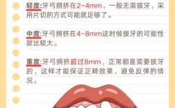 拔牙正畸容易反弹吗