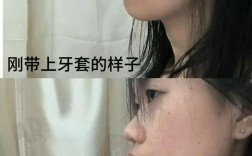 矫正牙齿脸会变吗