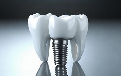 2025最新种植牙基桩包括哪些部分？