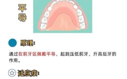 正畸弹簧在牙齿矫正中起什么具体作用？