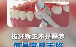 拔牙矫正牙齿过程图片能看清哪些关键步骤？