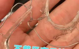 矫正后不戴保持器，牙齿会反弹吗？