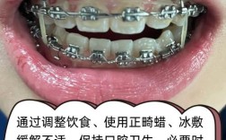 矫正牙齿过程疼吗？疼痛程度如何？