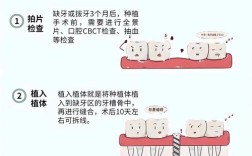 种牙过程中没牙期如何应对？具体有哪些美观实用的临时修复方案？