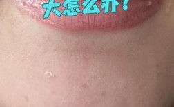 牙齿矫正后门牙为何留缝隙？