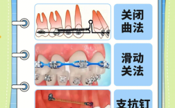 正畸间隙无法收完