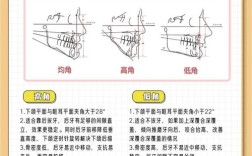 口腔正畸ANB角是什么？测量意义何在？