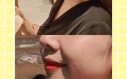 牙齿矫正还是美容冠