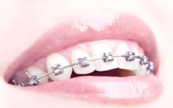 正畸中的牙齿片切