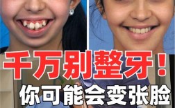 牙齿矫正后牙齿变长，是正常变化还是异常表现？该如何处理？