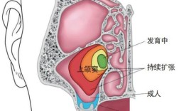 上颌窦底提升术常用方法有哪些？如何根据患者情况选择最佳术式？
