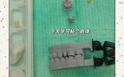 嵌体粘结方法的关键步骤是什么？