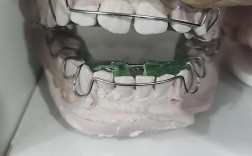 小诊所矫正牙齿靠谱吗？安全效果有保障吗？