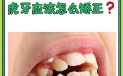 虎牙磨小矫正哪种方法最好？