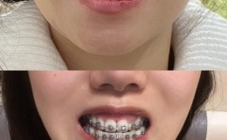 杭州牙齿矫正哪家靠谱？求推荐优质机构，选择攻略看这里！