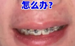 矫正牙齿移动痛，正常吗？如何缓解？