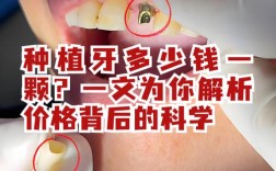 种牙种植体越贵越好吗