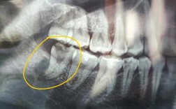 正畸致牙根吸收，患者起诉能获赔偿吗？