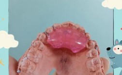 矫正牙齿戴导板，究竟有什么作用？