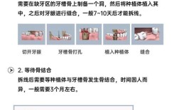 种的牙能使用多长时间