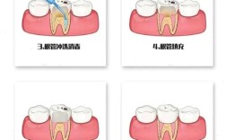 活髓牙出现龋坏或外伤时有哪些治疗方法？不同损伤程度下该如何选择，治疗后能维持多久，有哪些注意事项？