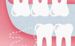 畸形牙的治疗方法有哪些？不同畸形类型该如何选择最佳方案？治疗周期和效果如何保障？