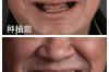 全口牙种牙哪里做好？靠谱医院和医生怎么选？
