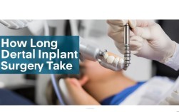 2025最新，种植牙种完要多久？