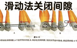 正畸如何有效关闭切牙间隙？具体方法有哪些？