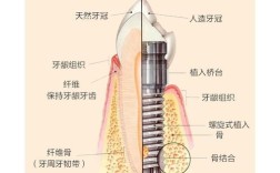 牙槽骨不足能种牙吗？种植牙有哪些应对解决方案？