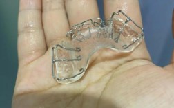 天包地牙齿矫正图片能真实直观展示矫正前后的改善效果吗？