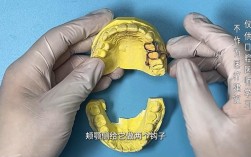 如何有效压低单个磨牙？具体方法与操作步骤有哪些？