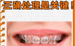 正畸的带环丢了怎么办