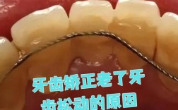 矫正牙齿老了牙齿松动
